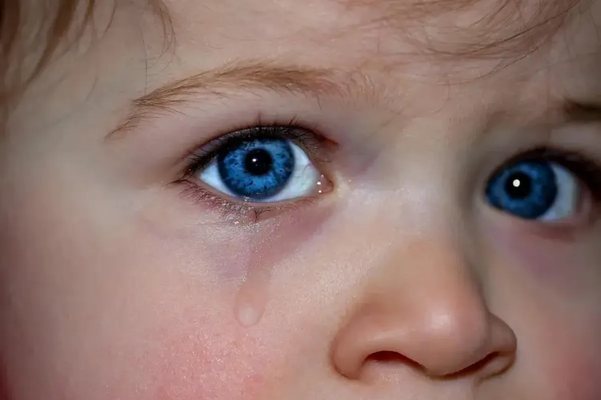 This is Coats disease, a rare eye disorder that can cause blindness in children and adolescents